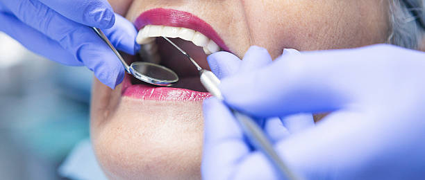 Best Emergency Treatment for Dental Infections or Abscesses in Nevada, IA